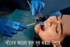 দাঁতের কালো দাগ দূর করার উপায় - Ways to remove black stains on teeth